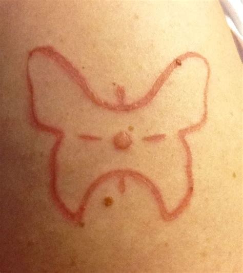 liquid nitrogen tattoo